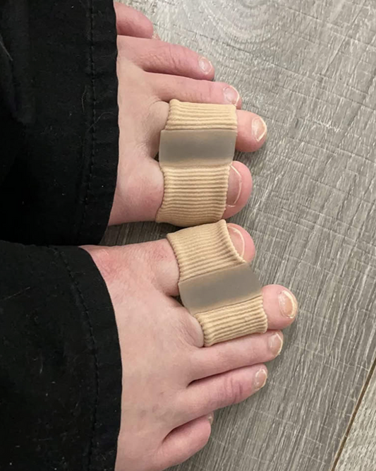 HYGGEAR Big Toe Bunion (Hallux Valgus) Aligner