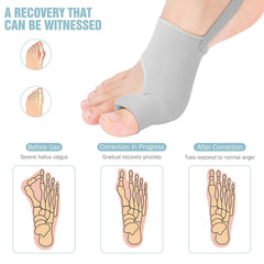 HYGGEAR Großzehen-Bunion-Korrektor (Hallux Valgus).